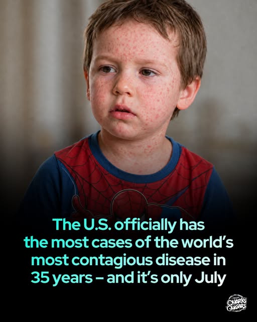 U.S. Measles Cases Hit 35-Year High — and the Situation Has Worsened Since July