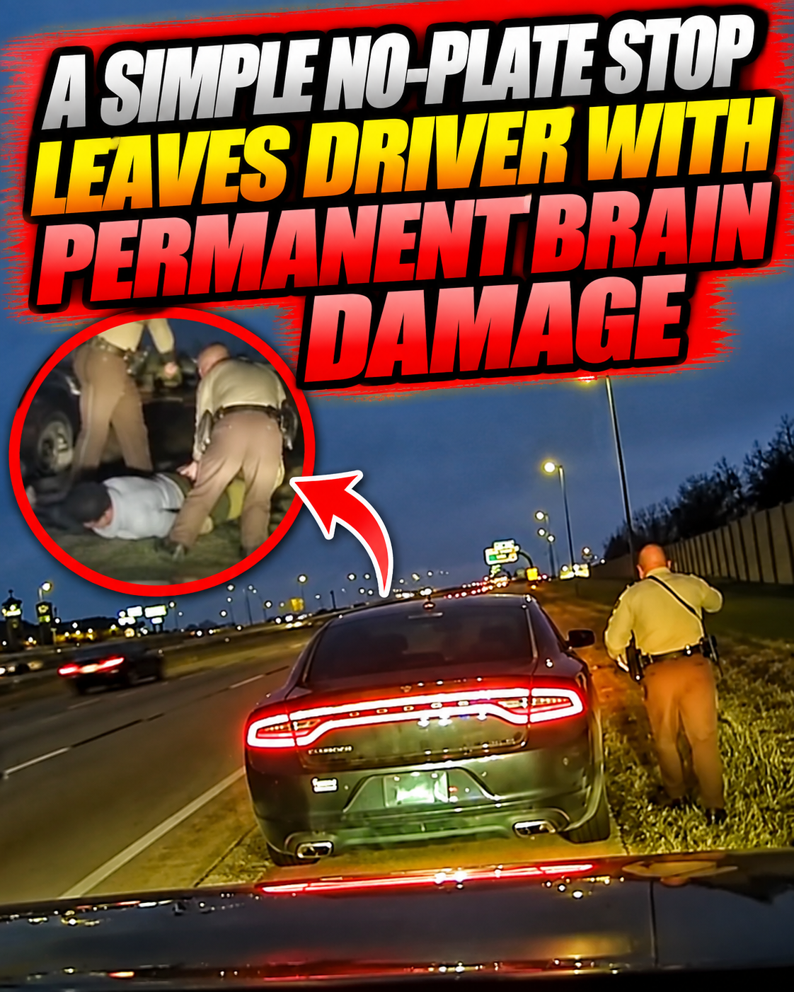 A Simple No-Plate Stop Leaves Driver With Permanent Brain Damage