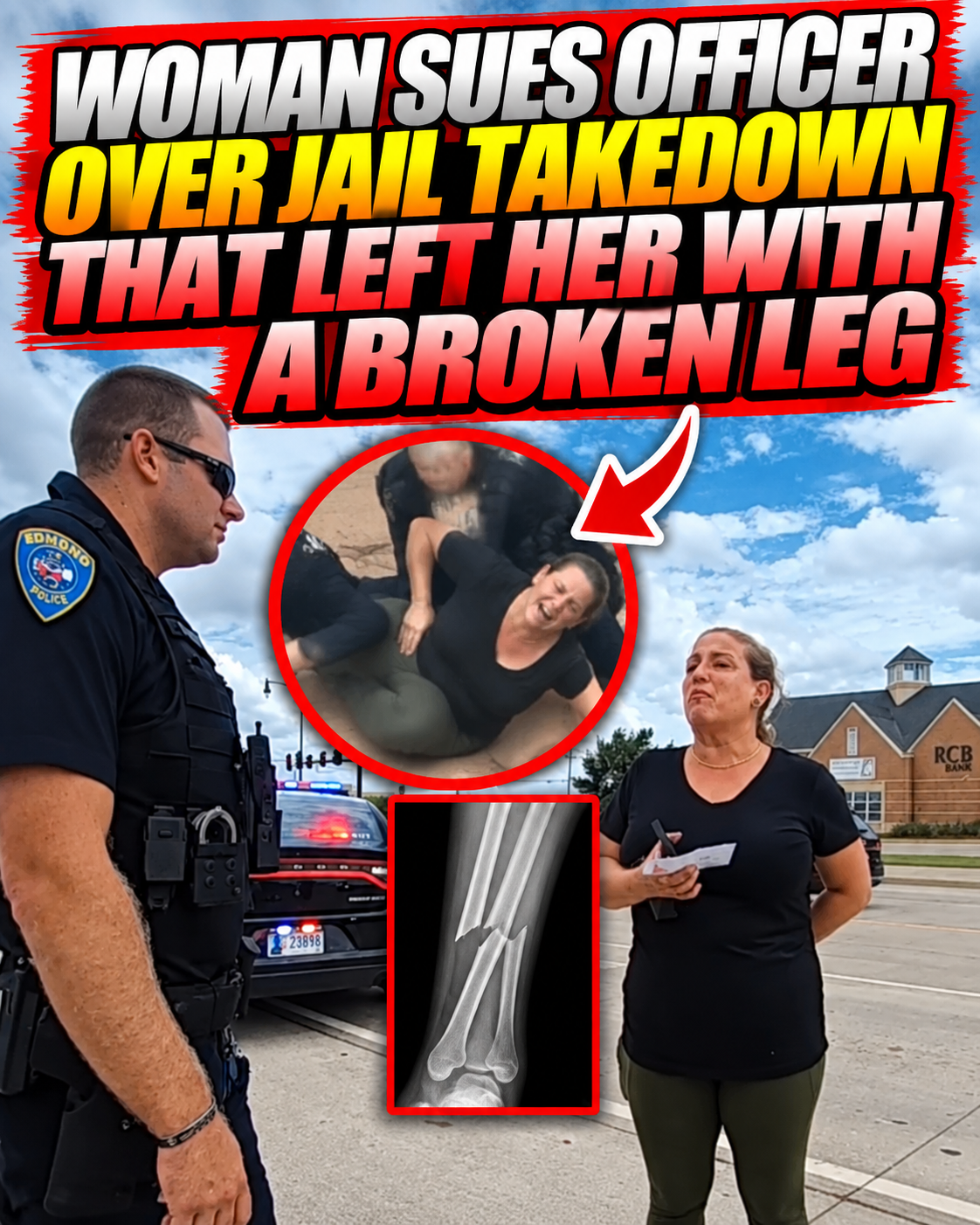 Woman Sues Officer Over Jail Takedown That Left Her With a Broken Leg